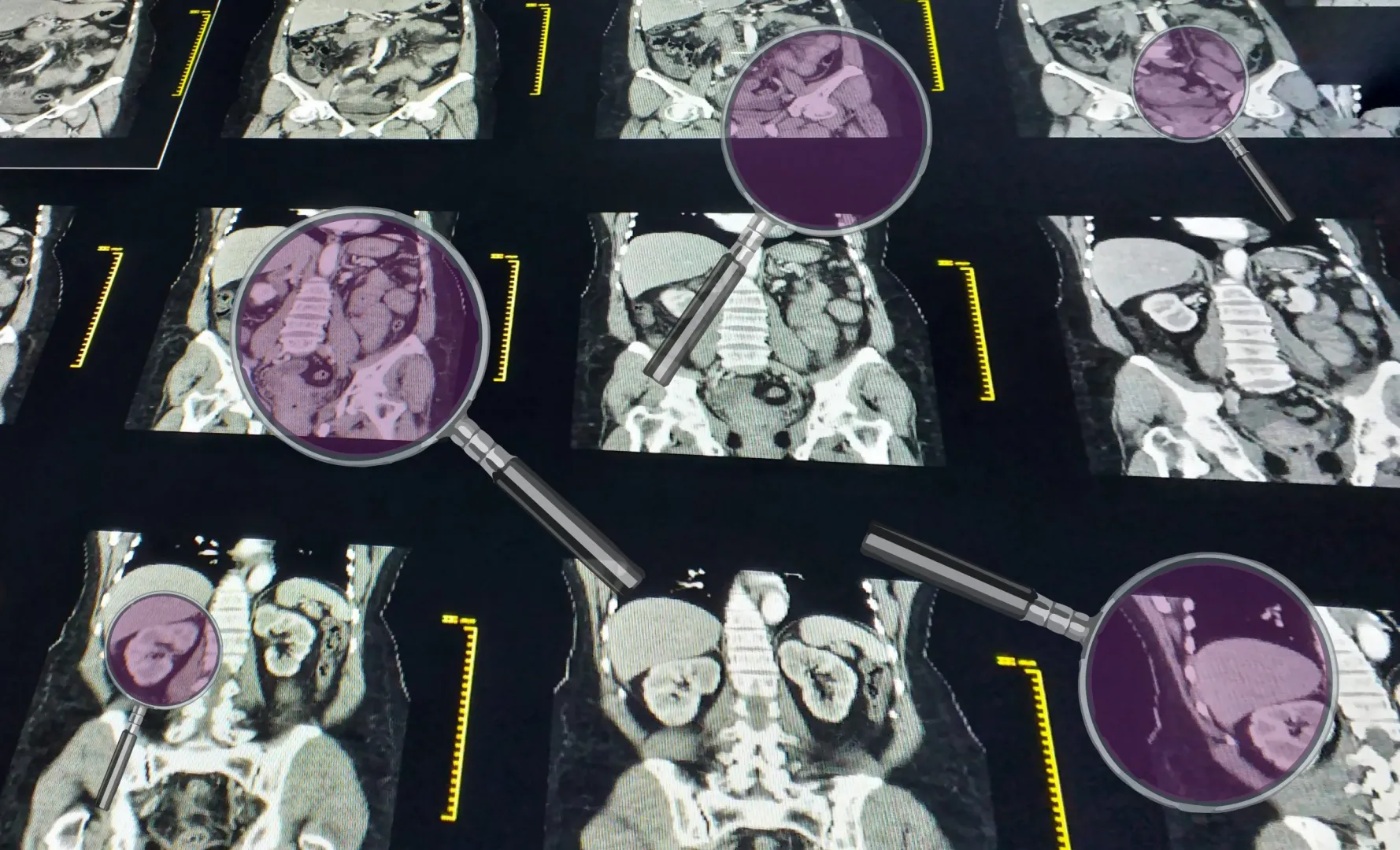 Module CT abdomen - Read like a radiologist