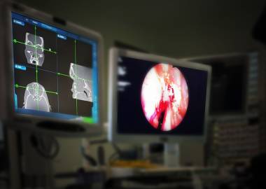 CT sinus