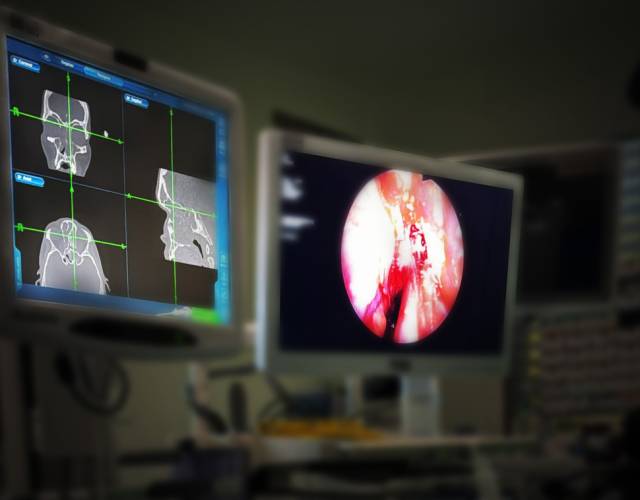Module CT Sinus