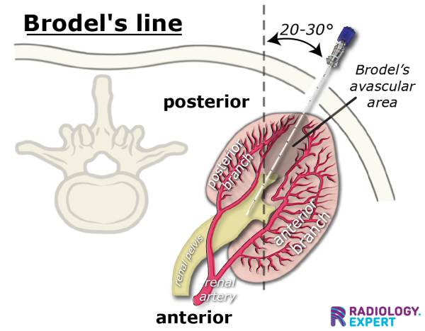 Interventional Radiology - Non-Oncological