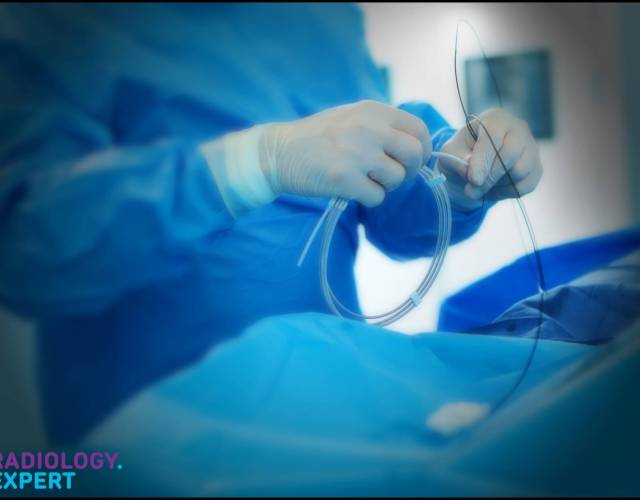 Interventie Radiologie - Niet-Oncologisch