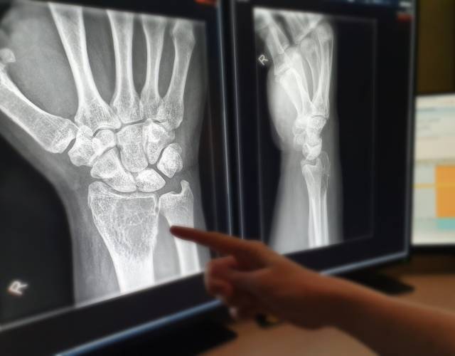 Bone tumours