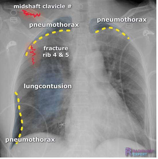 Indication and Requests for Radiological Examination