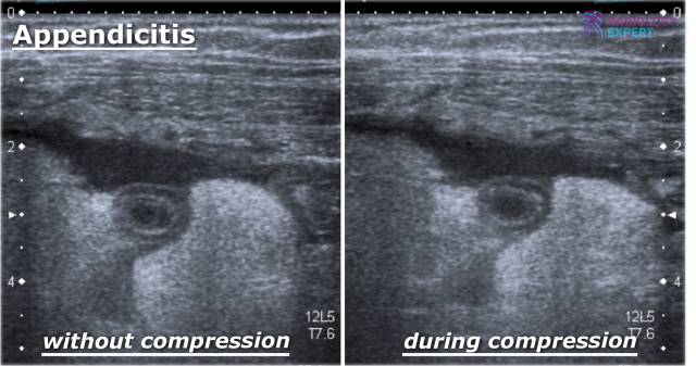 Indication and Requests for Radiological Examination