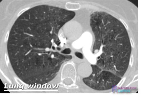 Indication and Requests for Radiological Examination