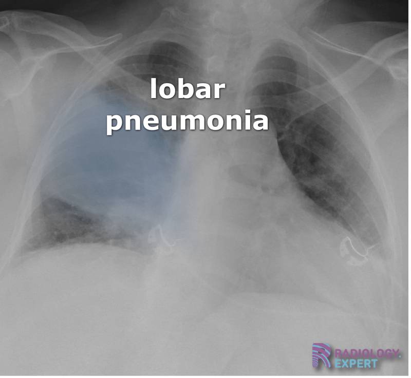 Indication and Requests for Radiological Examination