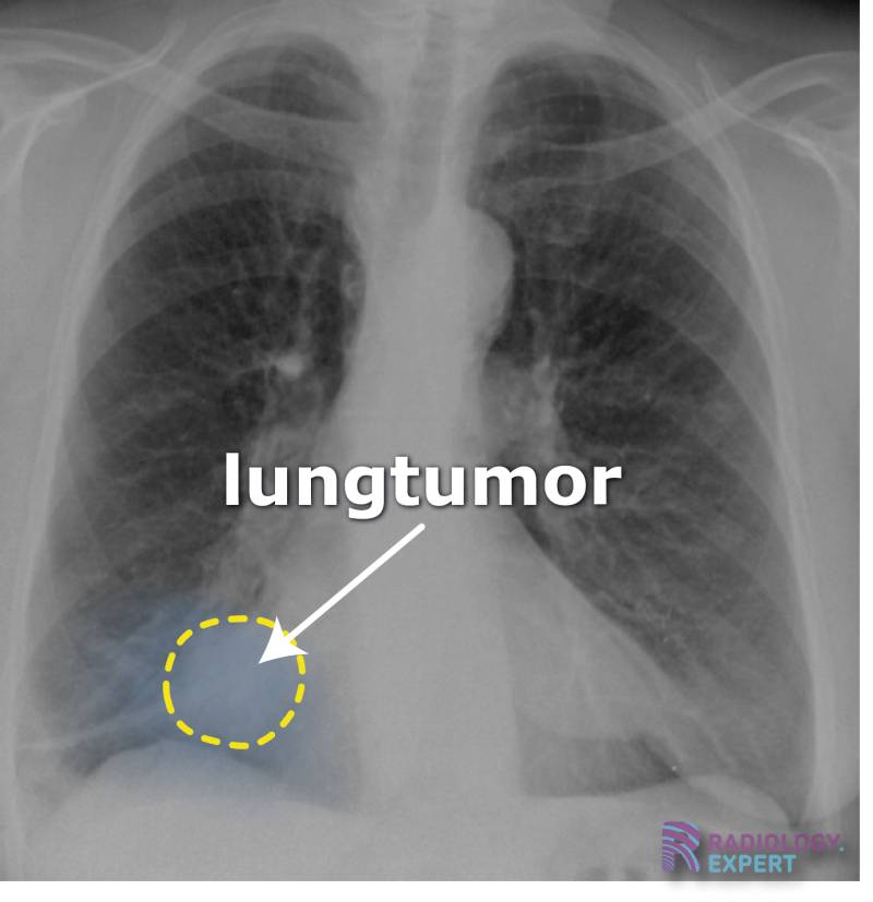 Indication and Requests for Radiological Examination