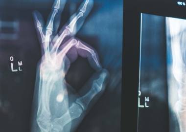 Indicatiestelling en Aanvragen Radiologisch Onderzoek