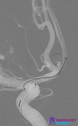 Interventional Radiology - General