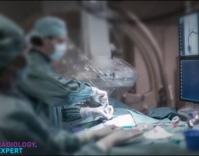 Interventieradiologie - Algemeen
