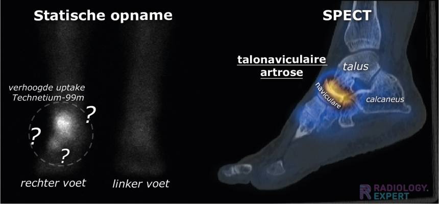 Nucleaire Geneeskunde
