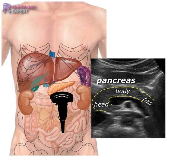 Abdominal ultrasound