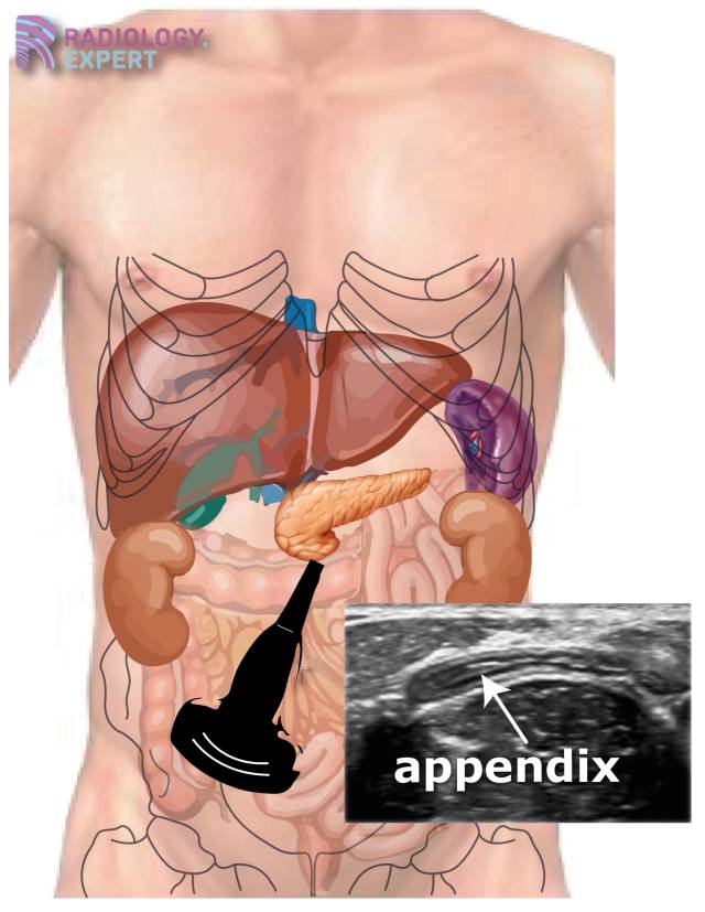 Abdominal ultrasound