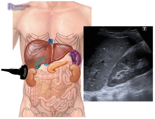 send Inferior loss Abdominal ultrasound
