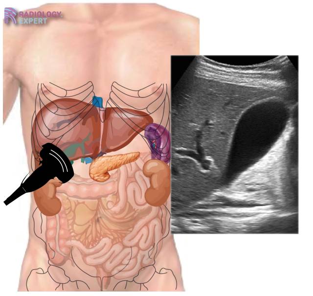 gallbladder ultrasound images