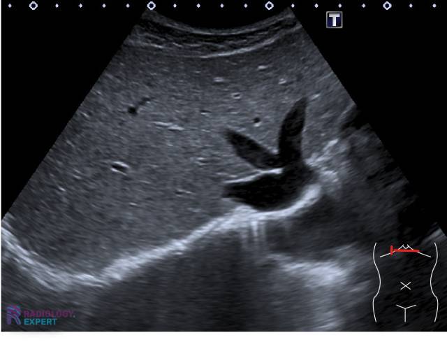 Normal Rabbit Echo Echo abdomen