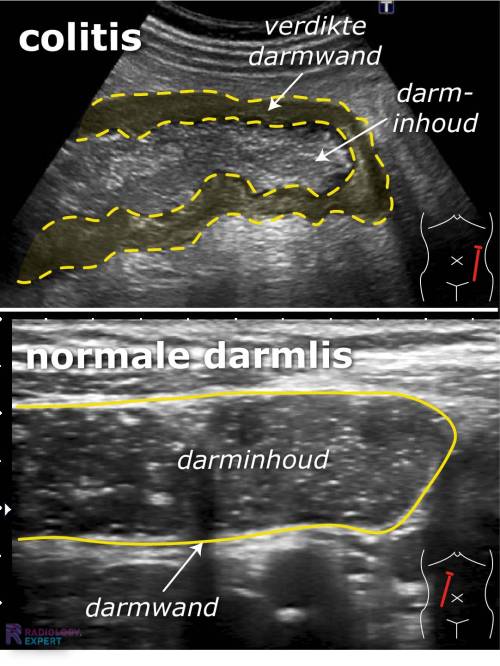 echo-abdomen