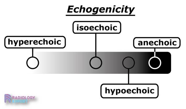 Echogenicity with corresponding terms.