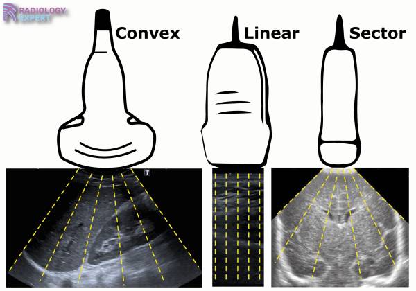 Ultrasound Technique