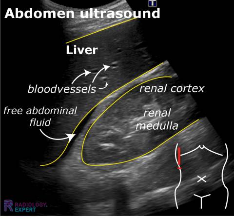 Ultrasound Technique