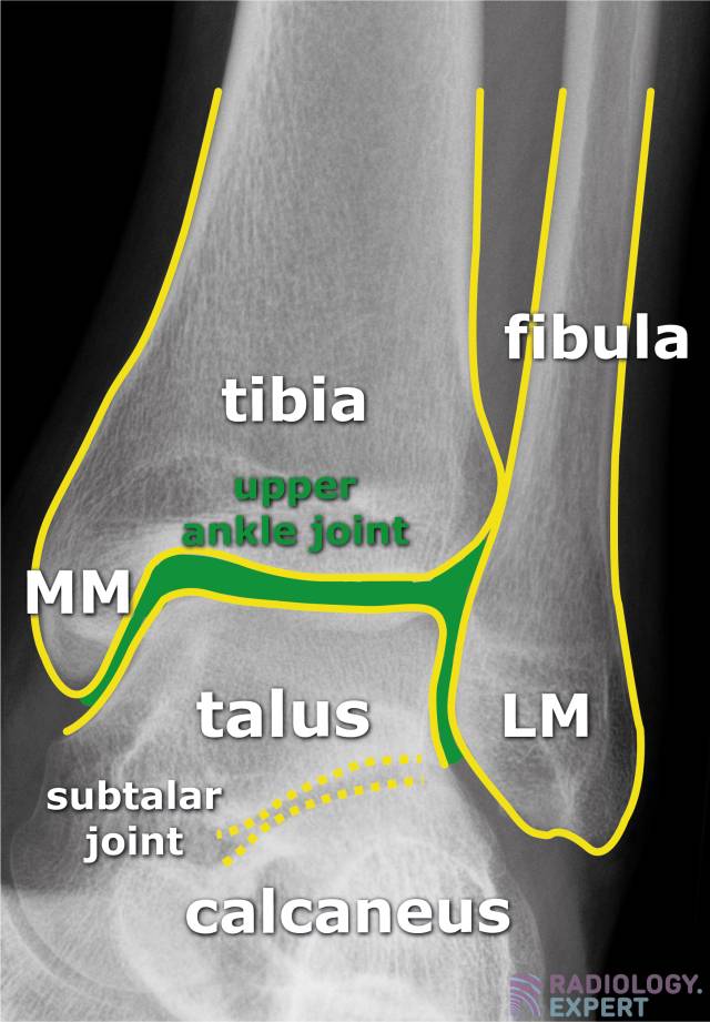 X ankle