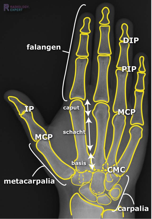 XHand