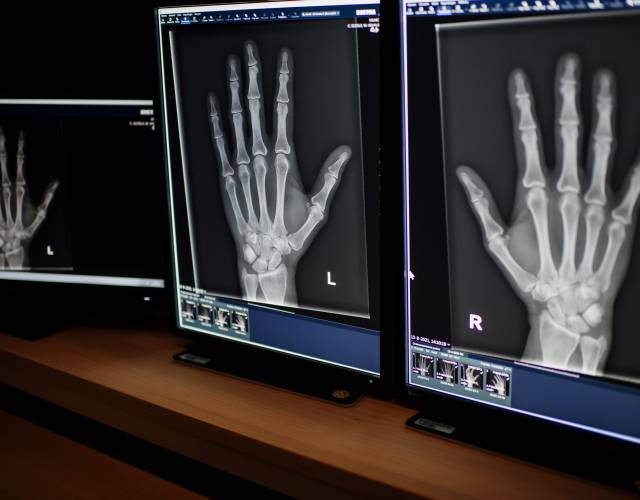 X-Hand