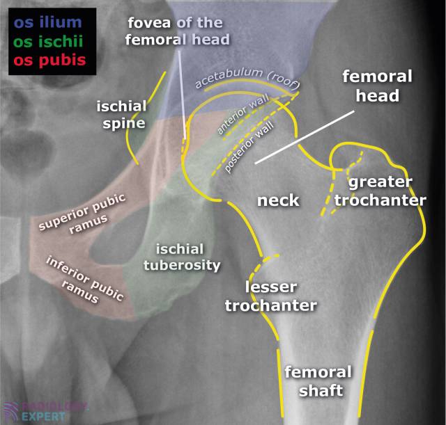 Normal anatomy AP image of the hip