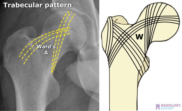 trabecular bone xray