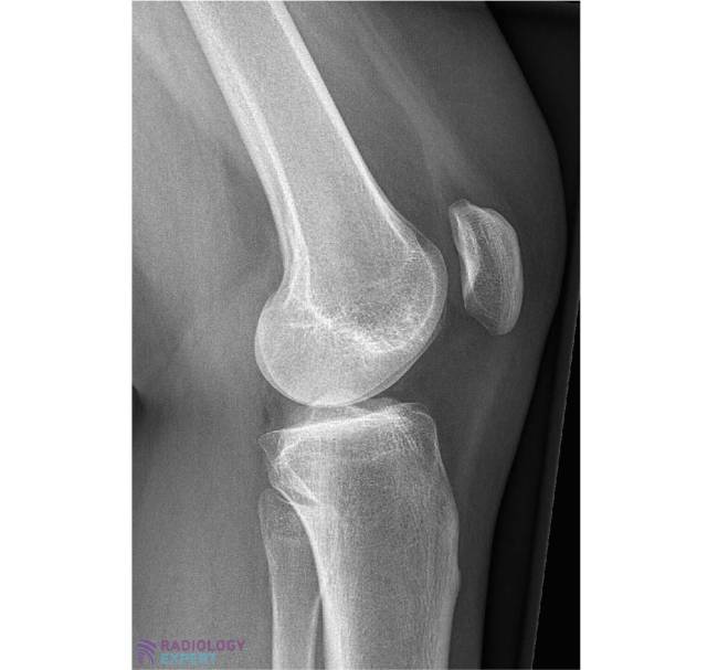 Knee cap xray new arrivals