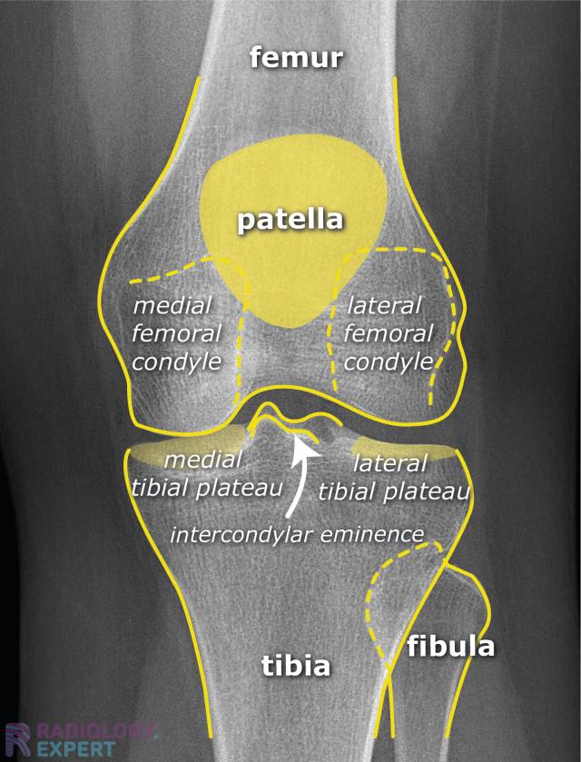 Intercondylar Fossa Tibia
