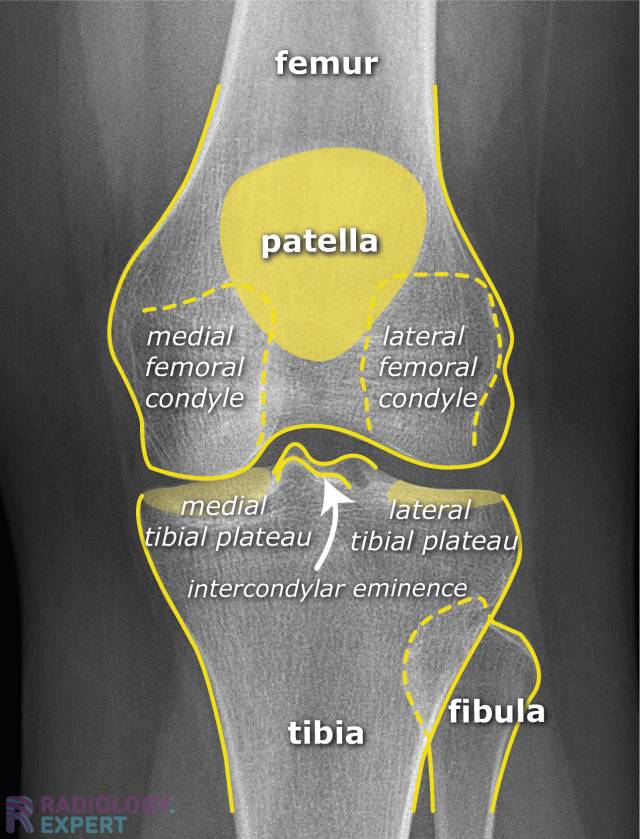 X Knee