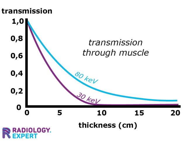 X-ray transmission and tissue tickness