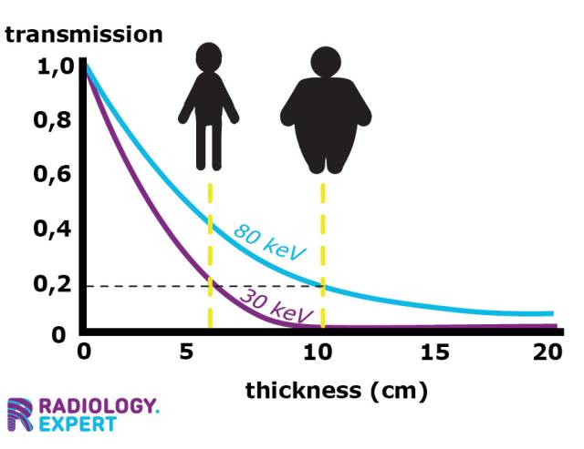 X-ray transmission and tissue tickness