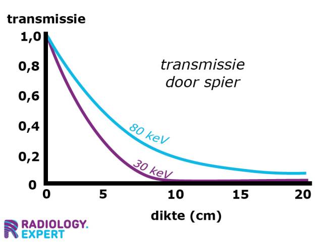 Rontgen transmissie en weefseldikte