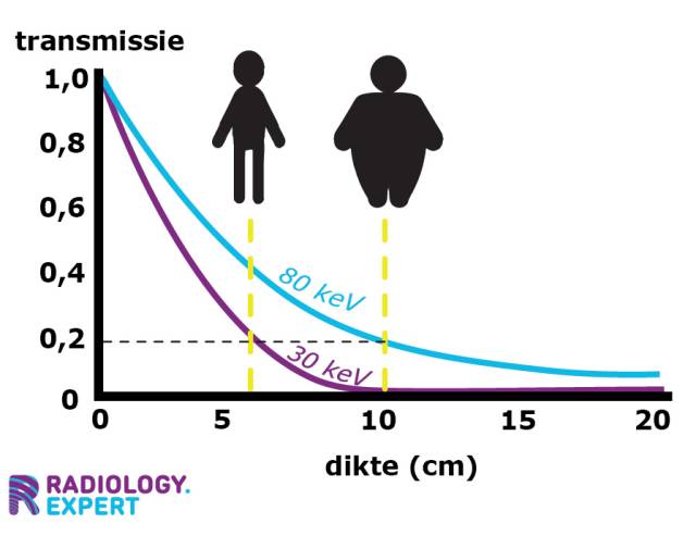 Rontgen transmissie en weefseldikte