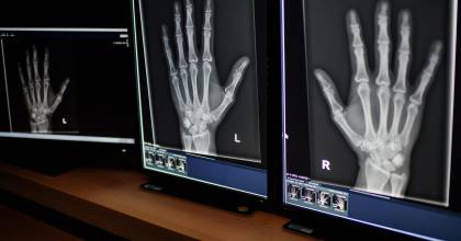 Rontgen/CT Techniek