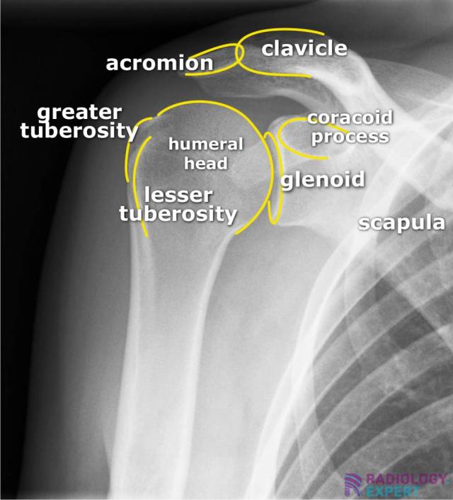 X Ray Shoulder Anatomy 534 Shoulder Xray Stock Photos High Res X Ray Shoulder Anatomy 534 Shoulder Xray Stock Photos High Res