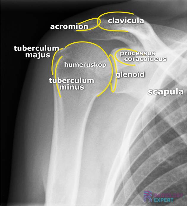 Normale schouder anatomie bij een AP-opname in exorotatie.