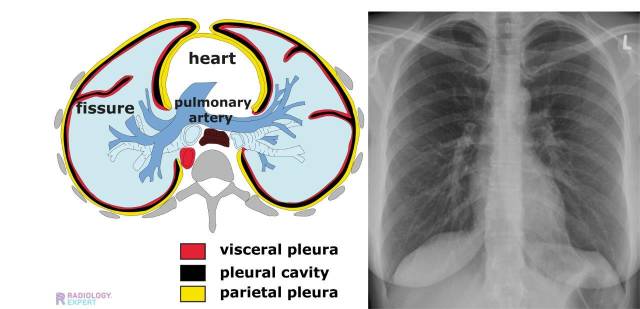 De pleuraruimte wordt gevormd door de pleura visceralis en de pleura parietalis.