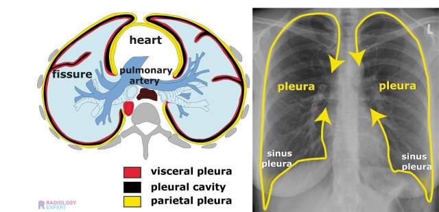 De pleuraruimte wordt gevormd door de pleura visceralis en de pleura parietalis.