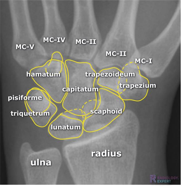 Normale anatomie carpalia.